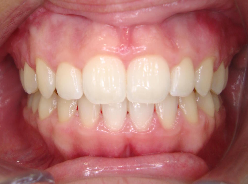 ortodontia2.2.JPG