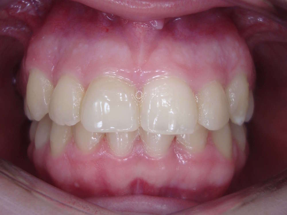 ortodontia4.2.JPG