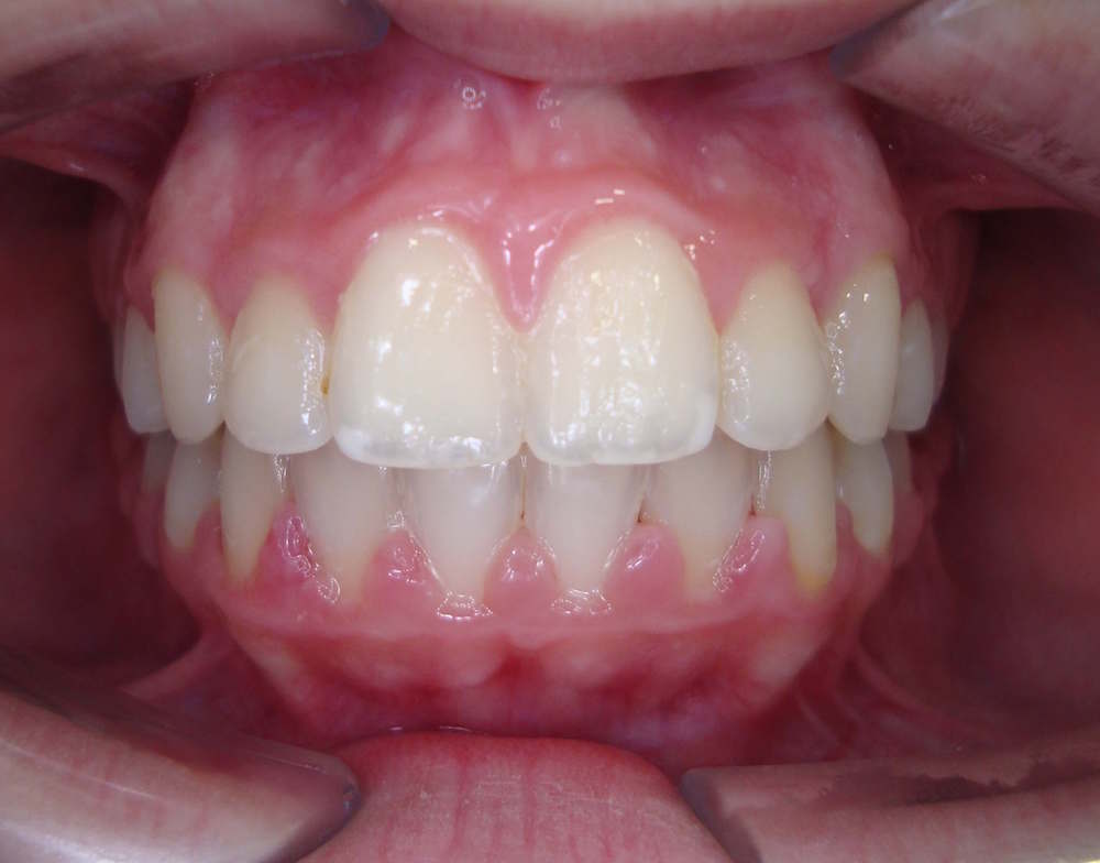ortodontia1.2.jpg