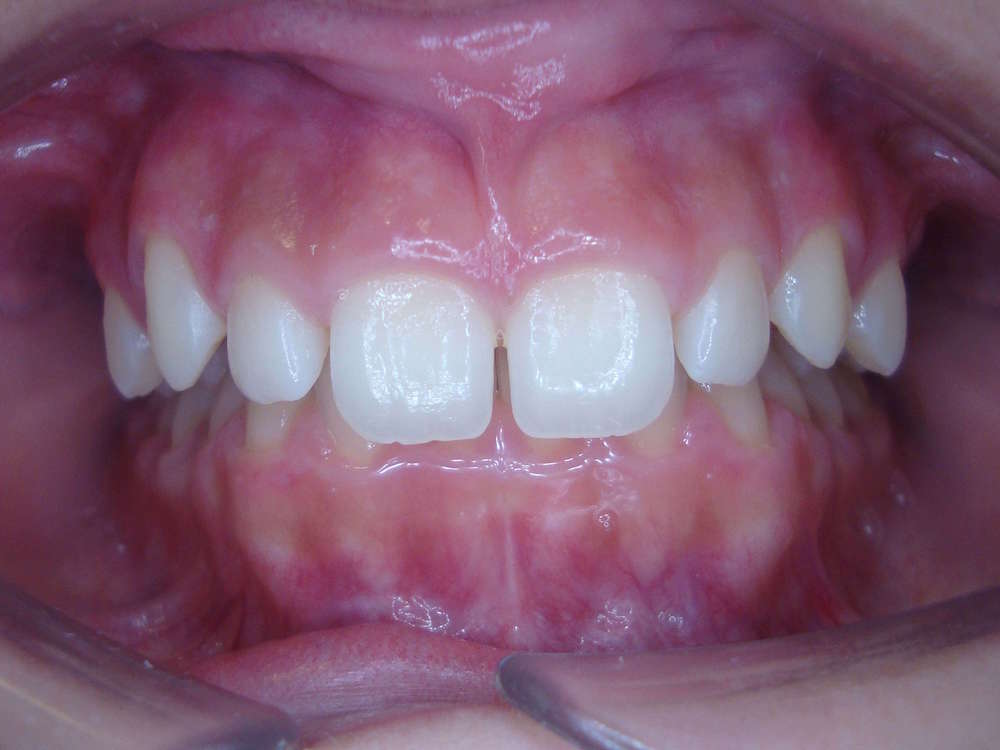 ortodontia2.1.jpg