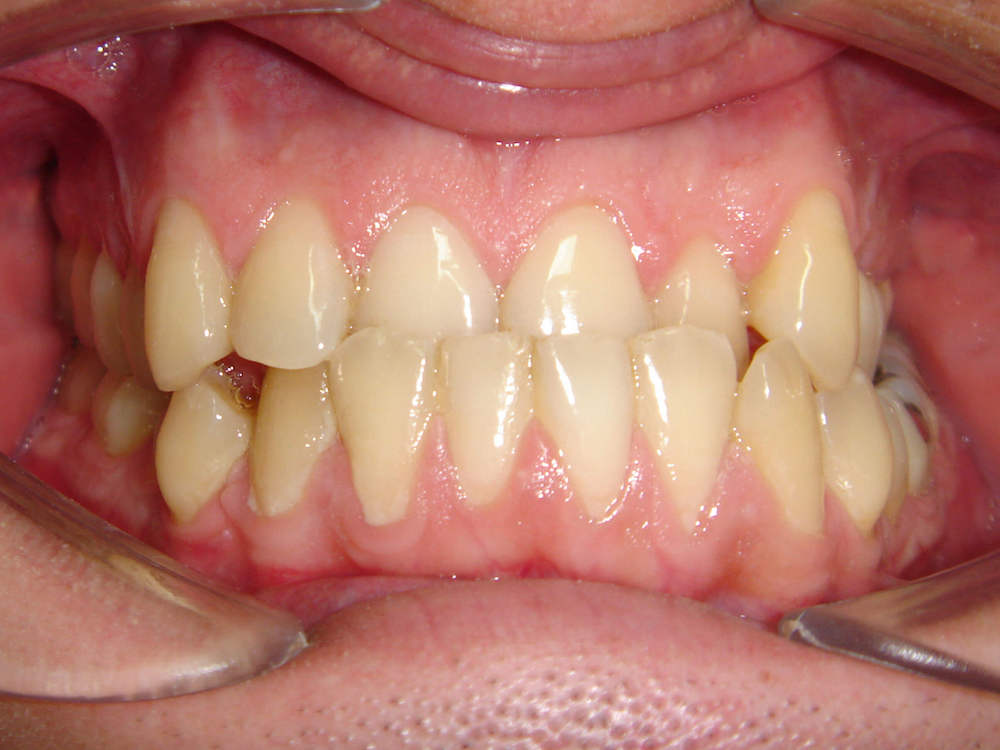 ortodontia3.1.JPG