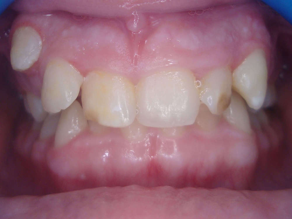 ortodontia4.1.JPG